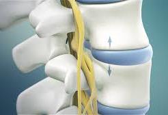Flexion-Distraction | Chiropractie Behandeling van Lage Rugpijn en Hernia